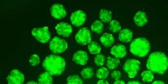 Green stem cell-derived pancreatic beta cells on a black background